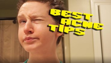 Casual Tips : Skincare Tips for Acne