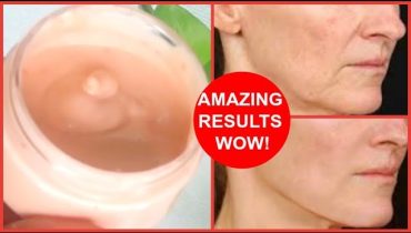 DO THIS TO LOOK 10 YEARS YOUNGER | TOMATO FACIAL | ANTI – AGING SKINCARE TIPS | Beauty Secrets